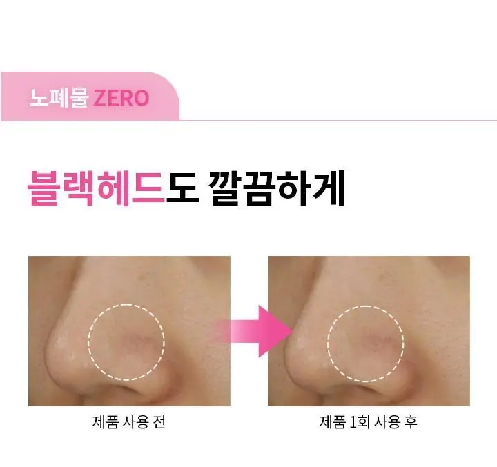 [1등 클렌징밤] 바닐라코 클린잇제로 오리지널 클렌징밤 100ml 상세페이지 20